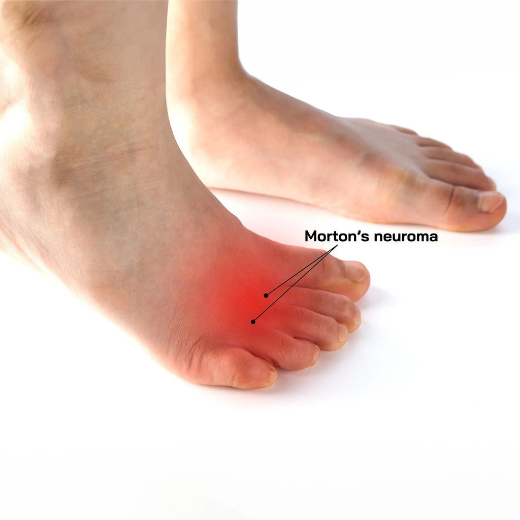 Orthopaedic shoes for Morton's Neuroma with orthotic insole.